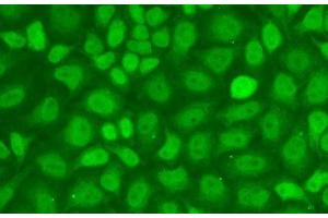 Immunofluorescence analysis of A-549 cells using CXXC1 Polyclonal Antibody (CXXC1 antibody)