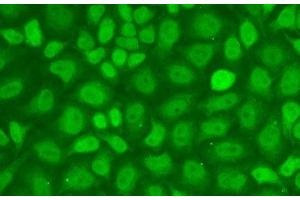 Immunofluorescence analysis of A-549 cells using CXXC1 Polyclonal Antibody