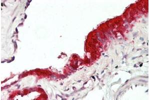 Anti-MXI1 / MAD2 antibody IHC staining of human lung, respiratory epithelium. (MXI1 antibody  (AA 176-225))
