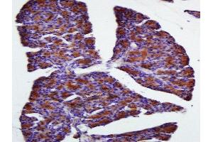 Immunohistochemistry (Paraffin-embedded Sections) (IHC (p)) image for anti-Family with Sequence Similarity 134, Member B (FAM134B) (AA 210-310) antibody (ABIN1714363)