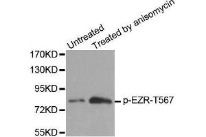Western blot analysis of extracts from MDA cells, using Phospho-EZR-T567 antibody. (Ezrin antibody  (pThr567))