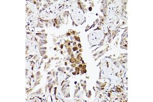 Immunohistochemistry (IHC) image for anti-Toll-Like Receptor 8 (TLR8) (AA 849-1041) antibody (ABIN3022015)