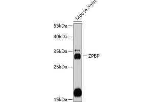 Western blot analysis of extracts of Mouse brain, using ZPBP antibody (ABIN7271569) at 1:1000 dilution. (ZPBP antibody  (AA 45-200))