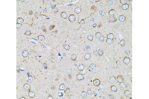 Immunohistochemistry of paraffin-embedded Rat brain using BEST1 Polyclonal Antibody at dilution of 1:100 (40x lens). (Bestrophin 1 antibody)