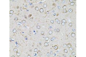 Immunohistochemistry of paraffin-embedded Rat brain using BEST1 Polyclonal Antibody at dilution of 1:100 (40x lens). (Bestrophin 1 antibody)