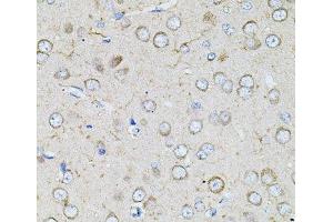 Immunohistochemistry of paraffin-embedded Rat brain using BEST1 Polyclonal Antibody at dilution of 1:100 (40x lens).
