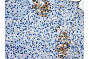 Immunohistochemical staining of paraffin-embedded liver tissue using anti-AKR1A1mouse monoclonal antibody. (AKR1A1 antibody)
