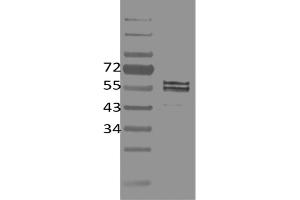 Image no. 1 for anti-Friend Leukemia Virus Integration 1 (FLI1) antibody (ABIN5067733) (FLI1 antibody)