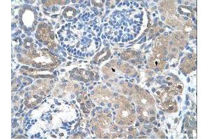 Image no. 1 for anti-Sarcosine Dehydrogenase (SARDH) (AA 94-143) antibody (ABIN320712) (SARDH antibody  (AA 94-143))