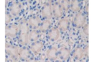 Detection of NEXN in Mouse Kidney Tissue using Polyclonal Antibody to Nexilin (NEXN) (NEXN antibody  (AA 421-607))
