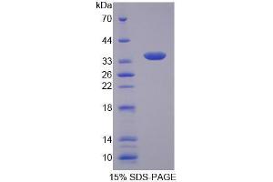 Slc25a1 Protein (AA 19-311) (His tag)