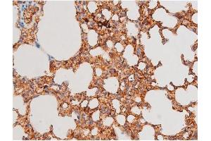 Immunohistochemistry (IHC) image for anti-GATA Binding Protein 4 (GATA4) (pSer262) antibody (ABIN6256227)