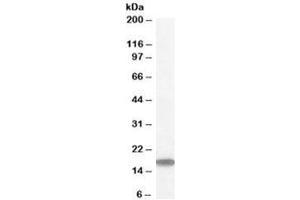 Western blot testing of human testis lysate with STMN1 antibody at 1ug/ml. (Stathmin 1 antibody)