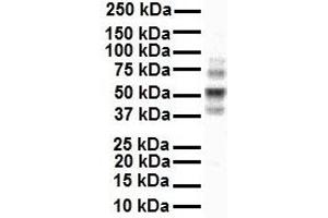 WB Suggested Anti-Ccnd1 antibody Titration: 1 ug/mL Sample Type: Human MCF7