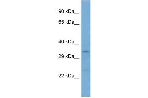 Western Blotting (WB) image for anti-Leucine Rich Repeat Containing 17 (LRRC17) (Middle Region) antibody (ABIN2784657) (LRRC17 antibody  (Middle Region))