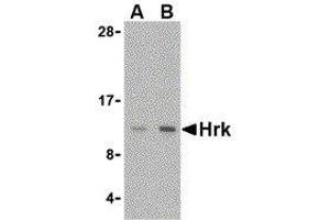 Western Blotting (WB) image for anti-Harakiri, BCL2 Interacting Protein (Contains Only BH3 Domain) (HRK) (Center) antibody (ABIN2474088) (HRK antibody  (Center))