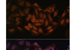 Immunofluorescence analysis of U-2 OS cells using CNBP Polyclonal Antibody at dilution of 1:100. (CNBP antibody)