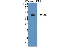 Figure. (EPB41 antibody  (AA 210-497))