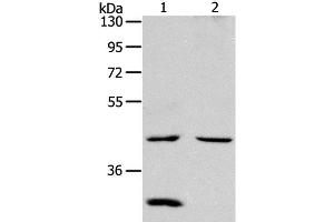 Western Blot analysis of Mouse kidney and heart tissue using NCEH1 Polyclonal Antibody at dilution of 1:1300 (NCEH1 antibody)