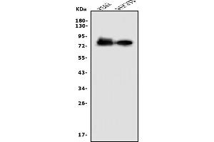 Western blot analysis of Nectin 2/NECTIN2 using anti-Nectin 2/NECTIN2 antibody (ABIN7601304).