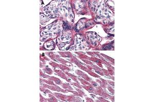 Immunohistochemical staining of formalin-fixed, paraffin-embedded human placenta (A) and human heart (B) tissue after heat-induced antigen retrieval. (ADCYAP1R1 antibody  (Extracellular Domain))