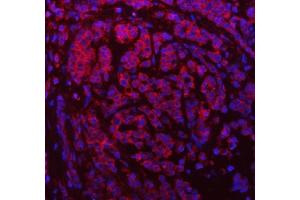IF analysis of SDF2L1 using anti-SDF2L1 antibody (ABIN7601111).