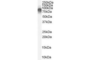 ABIN185665 (0. (Radixin antibody  (Internal Region))