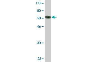 Western Blot detection against Immunogen (60. (FBXO8 antibody  (AA 1-319))