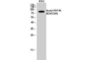 Western Blotting (WB) image for anti-Heat Shock Protein 90 (HSP90) (acLys284), (acLys292) antibody (ABIN6285474) (HSP90 antibody  (acLys284, acLys292))