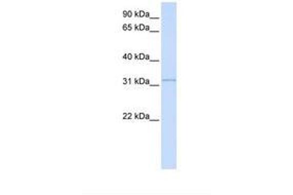 SUSD4 antibody  (N-Term)