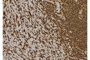 ABIN6277516 at 1/100 staining Human gastric tissue by IHC-P. (NDRG2 antibody  (C-Term))