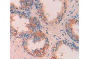IHC-P analysis of prostate gland tissue, with DAB staining.