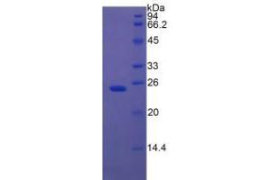 SDS-PAGE analysis of Rat Insulin Like Growth Factor Binding Protein 7 (IGFBP7) Protein.