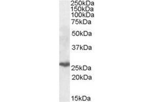 AP23684PU-N PSMB10 Antibody (0. (PSMB10 antibody  (Internal Region))