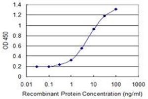 Detection limit for recombinant GST tagged CENPJ is 0. (CENPJ antibody  (AA 979-1088))