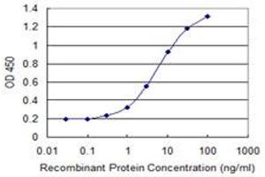 Detection limit for recombinant GST tagged CENPJ is 0.