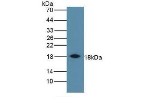 Detection of IFNg in Bovine Spleen using Monoclonal Antibody to Interferon Gamma (IFNg) (Interferon gamma antibody  (AA 24-166))