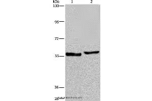 Western blot analysis of Human testis tissue and A375 cell, using SLC1A6 Polyclonal Antibody at dilution of 1:400 (SLC1A6 antibody)