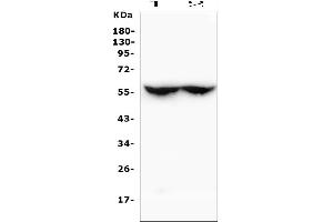 Western blot analysis of CYP2C19 using anti-CYP2C19 antibody (ABIN6719471).