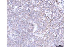 IHC analysis of PLCG 2/PLCG2 using anti-PLCG 2/PLCG2 antibody (ABIN5692854).