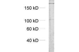 dilution: 1 : 1000, sample: crude synaptosomal fraction of rat brain (P2) (ITPR1 antibody  (AA 2731-2749))