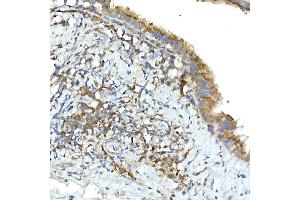 Immunohistochemistry of paraffin-embedded rat lung using TNF Rabbit pAb (ABIN3022984, ABIN3022985, ABIN3022986 and ABIN6219332) at dilution of 1:50 (40x lens). (TNFAIP3 antibody  (AA 1-190))