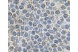 Image no. 3 for anti-Fibroblast Growth Factor 10 (FGF10) antibody (ABIN464943) (FGF10 antibody)