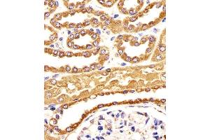 Immunohistochemical analysis of paraffin-embedded H. (BCAP31 antibody  (AA 120-147))