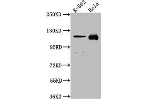 Western Blot Positive WB detected in: K562 whole cell lysate, Hela whole cell lysate All lanes: NUP98 antibody at 1:1000 Secondary Goat polyclonal to rabbit IgG at 1/50000 dilution Predicted band size: 198, 188, 98, 97, 196, 187 kDa Observed band size: 100 kDa