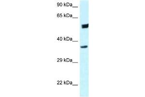 WB Suggested Anti-HOMER3 Antibody Titration: 1.
