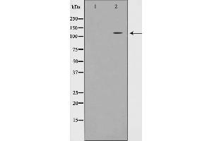 Western blot analysis on JK cell lysate using EPHA7 Antibody,The lane on the left is treated with the antigen-specific peptide. (EPH Receptor A7 antibody  (Internal Region))