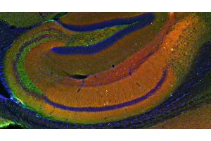 Indirect immunostaining of a PFA fixed mouse hippocampus section with anti-homer 1b/c (dilution 1 : 200; red) and mouse anti-synapsin 1 (cat. (Homer 1b/c (AA 152-354) antibody)