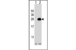 Western blot analysis of RAB3B (arrow) using RAB3B Antibody (C-term) Cat. (RAB3B antibody  (C-Term))
