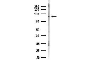 anti-PR Domain Containing 16 (PRDM16) (Internal Region) antibody